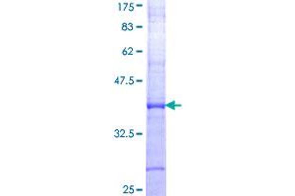 Angiotensin II Type-1 Receptor Protein (AA 250-359) (GST tag)