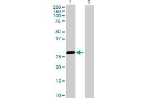 Western Blot analysis of HLA-DRB5 expression in transfected 293T cell line by HLA-DRB5 MaxPab polyclonal antibody. (HLA-DRB5 抗体  (AA 1-266))