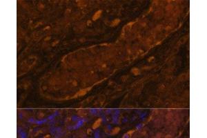 Immunofluorescence analysis of Human placenta using CFI Polyclonal Antibody at dilution of 1:100. (Complement Factor I 抗体)