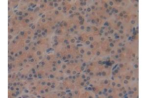 Immunohistochemistry (IHC) image for anti-ATPase, H+ Transporting, Lysosomal Accessory Protein 2 (ATP6AP2) (AA 18-302) antibody (ABIN1862221)