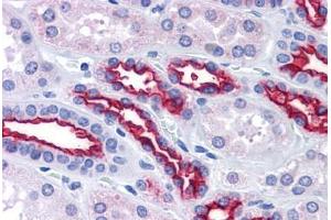 Kidney, Human: Formalin-Fixed, Paraffin-Embedded (FFPE) (MUC1 抗体)