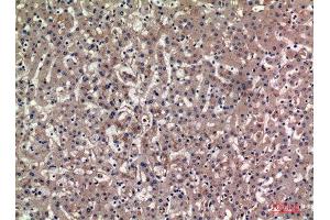 Immunohistochemistry (IHC) analysis of paraffin-embedded Human Liver, antibody was diluted at 1:100. (BAG3 抗体  (Internal Region))