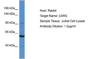 Host: Rabbit Target Name: CARS Sample Type: Jurkat Whole cell lysates Antibody Dilution: 1. (CARS 抗体  (N-Term))