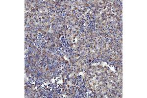 IHC analysis of SARS2 using anti-SARS2 antibody (ABIN7601804). (SARS2 抗体  (AA 46-518))