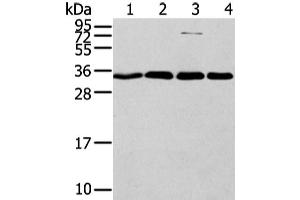Western Blot analysis of Hela, Jurkat, 293T and lovo cell using CBX7 Polyclonal Antibody at dilution of 1/200