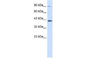 Human Jurkat; WB Suggested Anti-CCDC16 Antibody Titration: 1. (CCDC16 抗体  (Middle Region))