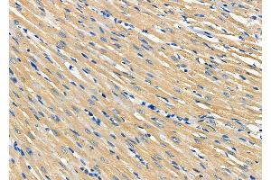 ABIN6264310 and ABIN6277668 at 1/100 staining Rat heart tissue by IHC-P. (PLTP 抗体  (Internal Region))