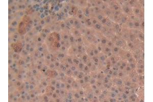 Used in DAB staining on fromalin fixed paraffin- embedded liver tissue (GSTP1 抗体  (AA 1-210))