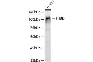Western blot analysis of extracts of A-431 cells, using THBD antibody (ABIN1683026, ABIN3018621, ABIN3018622 and ABIN6220518) at 1:1000 dilution. (Thrombomodulin 抗体  (AA 200-500))