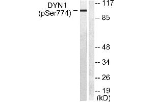Western blot analysis of extracts from mouse brain cells, using Dynamin-1 (Phospho-Ser774) Antibody (#A0422). (Dynamin 1 抗体  (pSer774))