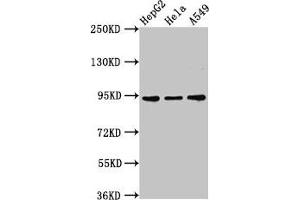 Western Blot Positive WB detected in: HepG2 whole cell lysate, Hela whole cell lysate, A549 whole cell lysate All lanes: CHD1L antibody at 3 μg/mL Secondary Goat polyclonal to rabbit IgG at 1/50000 dilution Predicted band size: 101, 91, 78, 89, 70 kDa Observed band size: 91 kDa (CHD1L 抗体  (AA 704-897))