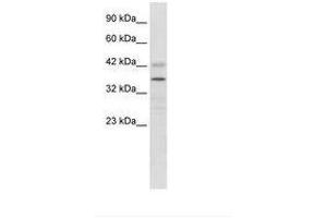 Image no. 2 for anti-Proline Rich 7 (Synaptic) (PRR7) (AA 160-209) antibody (ABIN6735904) (PRR7 抗体  (AA 160-209))
