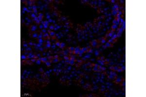 Immunofluorescence (Paraffin-embedded Sections) (IF (p)) image for anti-Protein Tyrosine Phosphatase G1 (PTPN12) antibody (ABIN7075292)