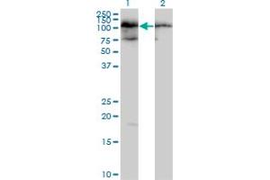 Western Blotting (WB) image for anti-TATA Box Binding Protein (TBP)-Associated Factor, RNA Polymerase I, C, 110kDa (TAF1C) (AA 1-775) antibody (ABIN522443)