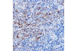 Immunohistochemistry of paraffin-embedded rat spleen using CX3CR1 Rabbit pAb (ABIN3016929, ABIN3016930, ABIN1679440 and ABIN6219885) at dilution of 1:25 (40x lens). (CX3CR1 抗体)