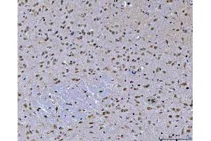 IHC analysis of ZMYND8 using anti-ZMYND8 antibody (ABIN7598947).