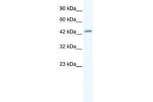 WB Suggested Anti-DMRTB1 Antibody Titration:  5. (DMRTB1 抗体  (Middle Region))