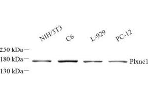 Western blot analysis of Plxnc1 (ABIN7075109)at dilution of 1: 1000 (Plexin C1 抗体)