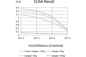 Black line: Control Antigen (100 ng),Purple line: Antigen (10 ng), Blue line: Antigen (50 ng), Red line:Antigen (100 ng) (SAA1 抗体  (AA 19-212))