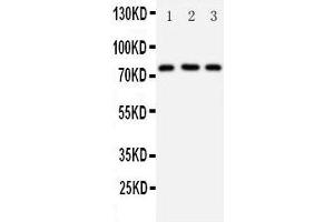 Anti-DDX4/MVH antibody, Western blotting Lane 1: Rat Testis Tissue Lysate Lane 2: Mouse Testis Tissue Lysate Lane 3: HELA Cell Lysate (DDX4 抗体  (Middle Region))