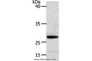 Western blot analysis of Human liver cancer tissue, using RARRES1 Polyclonal Antibody at dilution of 1:300 (RARRES1 抗体)