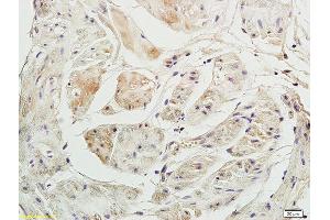 Immunohistochemistry (IHC) image for anti-Purinergic Receptor P2x, Ligand-Gated Ion Channel, 3 (P2RX3) (AA 241-340) antibody (ABIN705866)