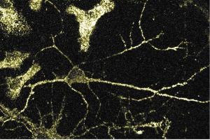 Immunofluorescence staining of rat neurons. (alpha Adaptin 抗体  (AA 38-215))