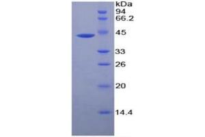 SDS-PAGE of Protein Standard from the Kit (Highly purified E. (CKM ELISA 试剂盒)