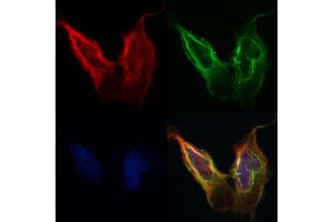 ABIN6260703 and ABIN6268787 staining Hela by IF/ICC. (N-Cadherin 抗体  (C-Term))