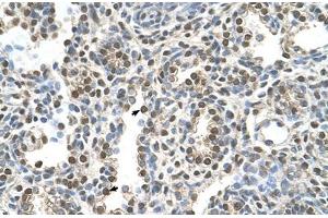 Immunohistochemical staining (Formalin-fixed paraffin-embedded sections) of human lung with MAGEA8 polyclonal antibody . (MAGEA8 抗体  (AA 51-100))
