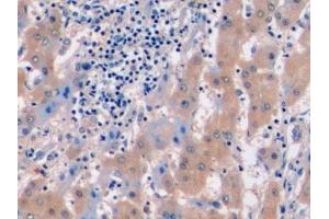 Immunohistochemistry (IHC) image for anti-Met Proto-Oncogene (MET) (AA 1092-1379) antibody (ABIN7434734)