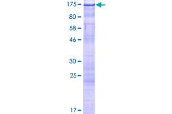 RNF213 Protein (AA 1-1063) (GST tag)