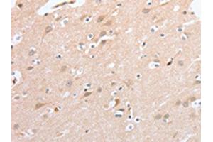 The image on the left is immunohistochemistry of paraffin-embedded Human brain tissue using ABIN7131058(SIGLEC9 Antibody) at dilution 1/40, on the right is treated with fusion protein. (SIGLEC9 抗体)