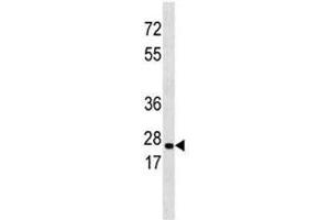 ERAB antibody western blot analysis in 293 lysate (Endoplasmic Reticulum Amyloid Binding Protein (ERAB) (AA 199-235) 抗体)