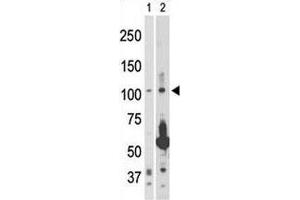 NIK antibody used in western blot to detect NIK in 293 cell lysate (Lane 1) and rat testis tissue lysate (2). (MAP3K14 抗体  (AA 119-148))
