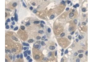 Immunohistochemistry (IHC) image for anti-Anthrax Toxin Receptor 2 (ANTXR2) (AA 34-318) antibody (ABIN7435958)