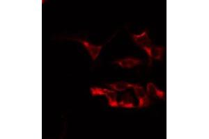 Immunofluorescence (fixed cells) (IF/ICC) image for anti-Branched Chain Ketoacid Dehydrogenase Kinase (BCKDK) (N-Term) antibody (ABIN6260219)