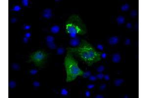 Anti-MCL1 mouse monoclonal antibody (ABIN2453278) immunofluorescent staining of COS7 cells transiently transfected by pCMV6-ENTRY MCL1 (RC200521). (MCL-1 抗体)