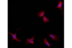 ABIN6259277 and ABIN6275432 staining HepG2 by IF/ICC.