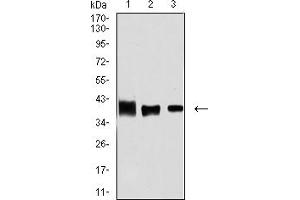 Western blot analysis using ALDOA mouse mAb against MCF-7 (1), Hela (2), and NIH/3T3 (3) cell lysate. (ALDOA 抗体  (AA 9-145))