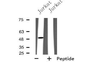 Western blot analysis of extracts from Jurkat cells, using GPR142 antibody. (GPR142 抗体  (Internal Region))