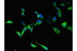 Immunofluorescence (IF) image for anti-Chromosome 22 Open Reading Frame 28 (C22orf28) (AA 52-229) antibody (ABIN7173542)