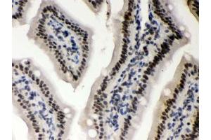 IHC testing of FFPE mouse intestine with CSNK1A1 antibody. (CSNK1A1 抗体)