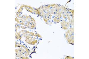 Immunohistochemistry of paraffin-embedded mouse heart using GPLD1 antibody (ABIN5973975) at dilution of 1/100 (40x lens). (GPLD1 抗体)