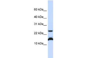 WB Suggested Anti-BATF Antibody Titration:  0. (BATF 抗体  (N-Term))