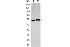 Western blot analysis using CA9 mouse mAb against Hela (1) and A549 (2) cell lysate. (CA9 抗体)