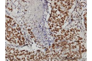 Immunostaining (ISt) image for anti-Topoisomerase I Binding, arginine/serine-Rich, E3 Ubiquitin Protein Ligase (TOPORS) (AA 98-205) antibody (ABIN564418)