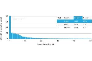 Analysis of Protein Array containing more than 19,000 full-length human proteins using IL3RA / CD123 Rabbit Recombinant Monoclonal Antibody (IL3RA /2947R). (Recombinant IL3RA 抗体  (AA 26-171))