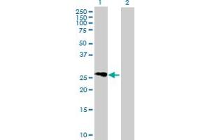 Western Blot analysis of FLJ25006 expression in transfected 293T cell line by FLJ25006 MaxPab polyclonal antibody. (FLJ25006 (AA 1-274) 抗体)