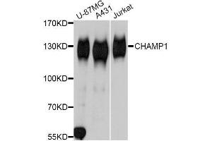 Western blot analysis of extracts of various cell lines, using CHAMP1 Antibody. (ZNF828 抗体  (AA 563-812))